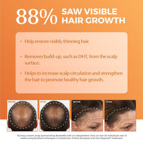 BosleyMD bosrevive saw palmetto ingredient closeup supporting scalp care