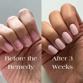 Before-and-after nails using Botanist The Remedy demonstrating stronger-looking nails benefit