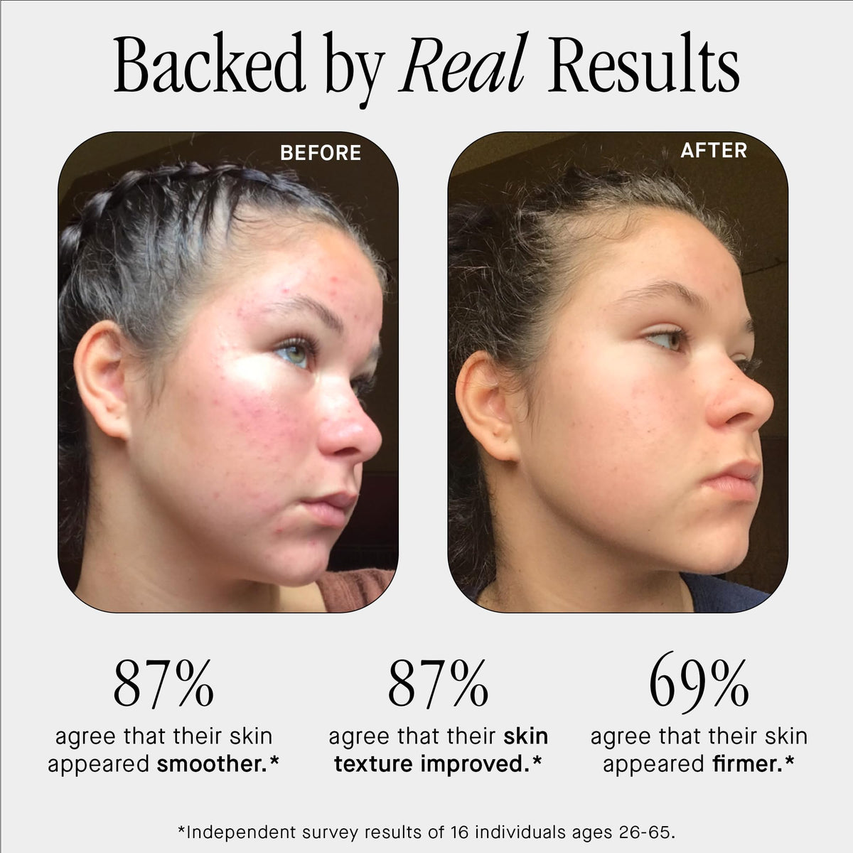 Brandefy serum droplet texture illustrating lightweight plumping benefit