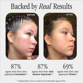Brandefy serum droplet texture illustrating lightweight plumping benefit