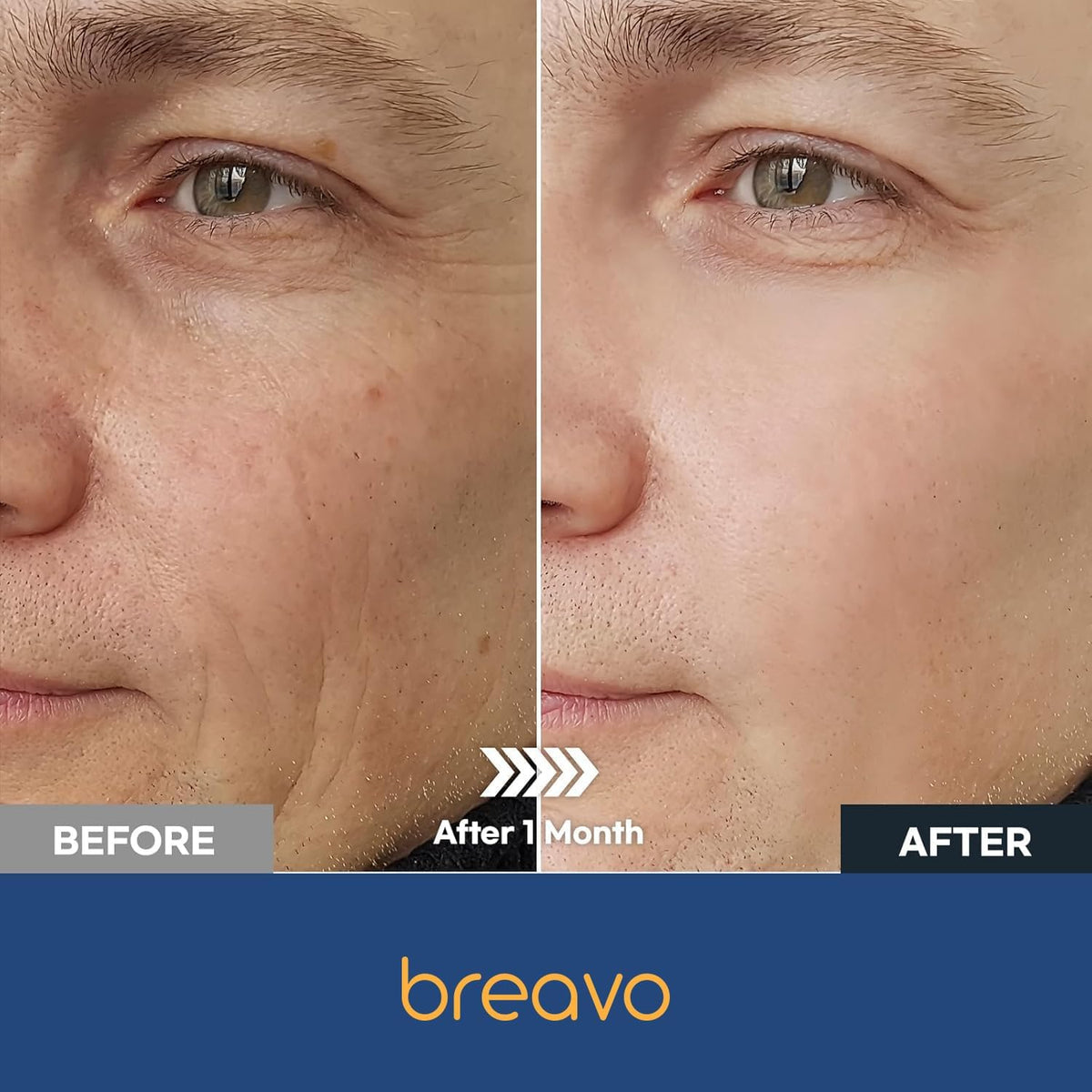 Breavo cream on hand demonstrating quick absorption and matte finish
