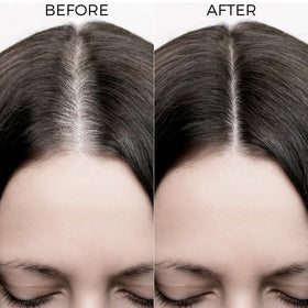 BRILLARE applying oil shots to scalp for targeted nourishment benefit