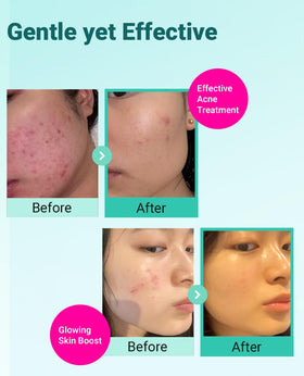 bring green zinc teca serum dropper applying targeted treatment