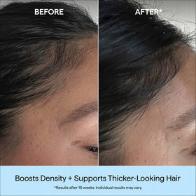 Applying Briogeo serum to scalp for targeted density support