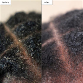 Briogeo charcoal texture close-up illustrating detoxifying ingredient action