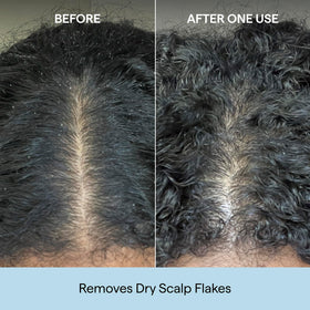 briogeo close-up of plant-based microcrystalline cellulose exfoliant for safe debris removal