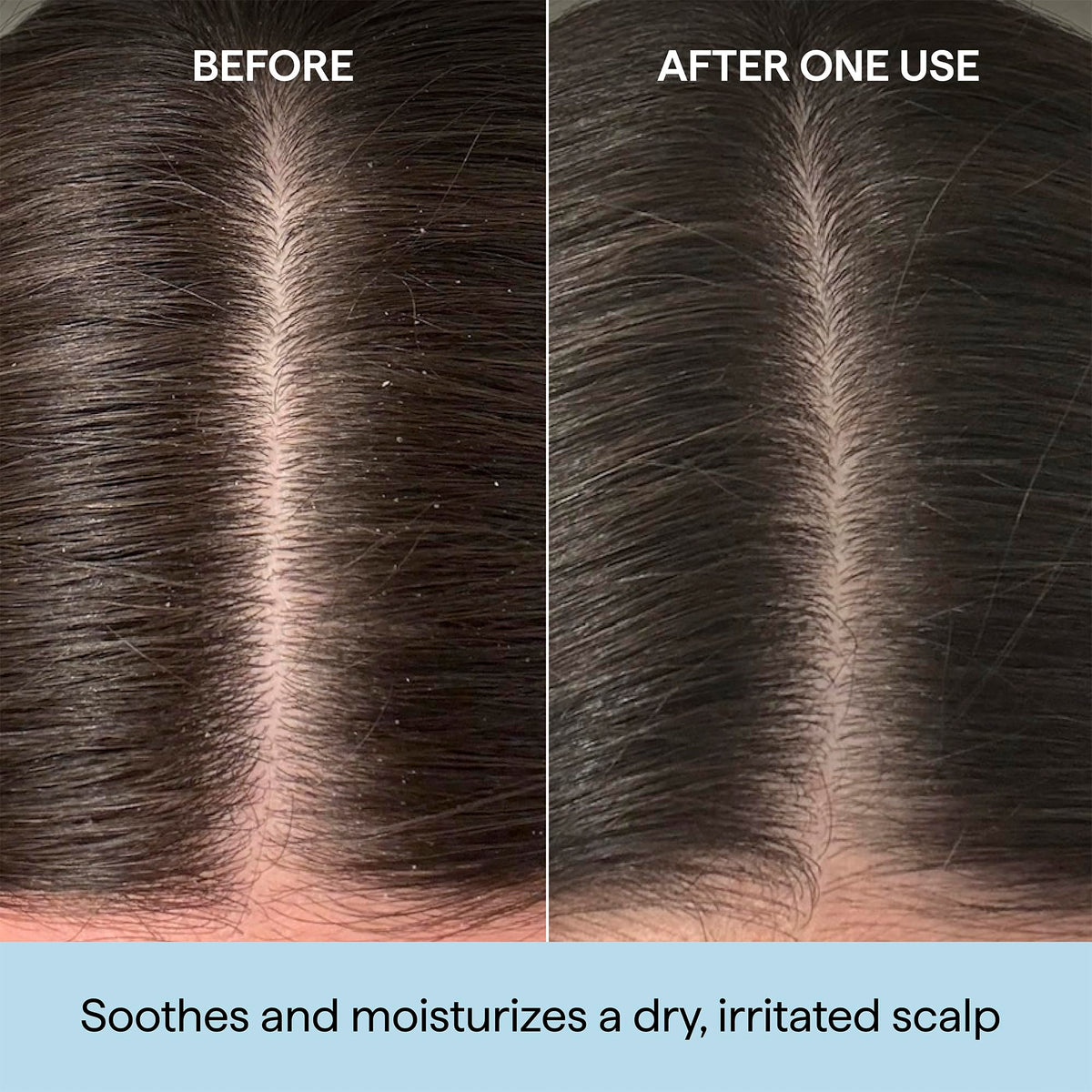 Briogeo precision applicator tip for targeted scalp dosing