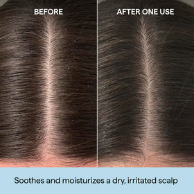 Briogeo precision applicator tip for targeted scalp dosing
