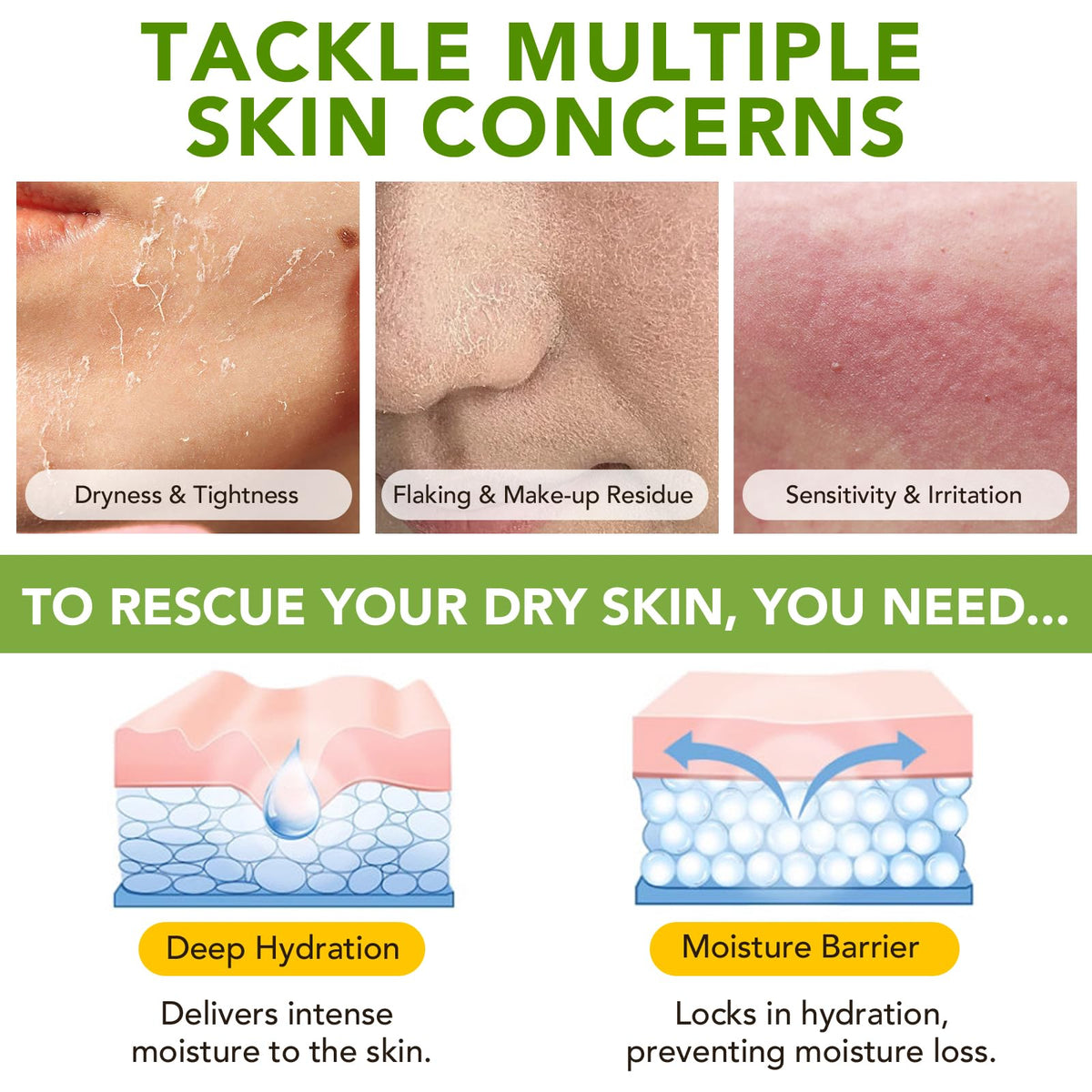 Btefls used on hands and elbows to restore soft skin