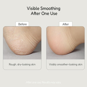 BuffOut before and after feet comparison illustrating smoother, refined skin