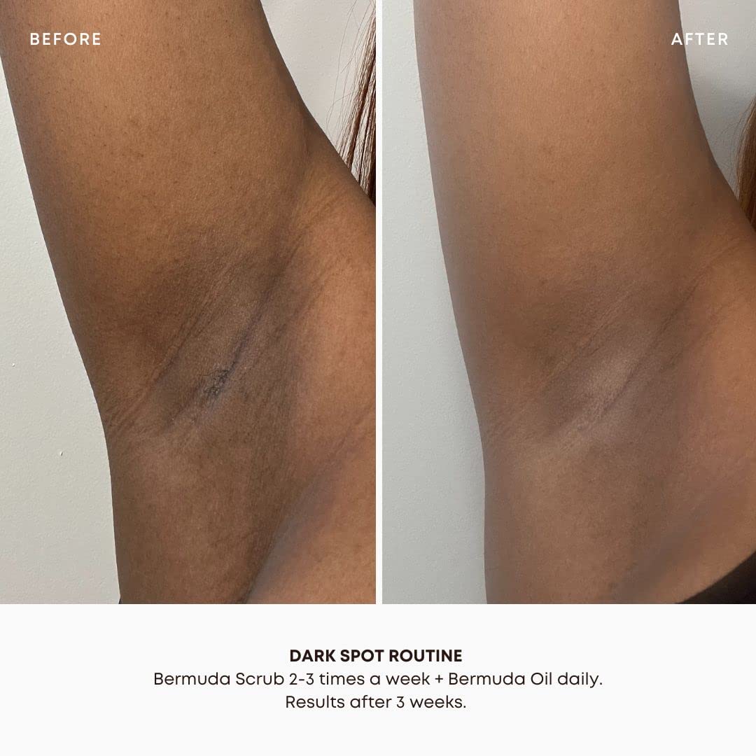 Bushbalm application on leg demonstration showing reduced bumps and softer regrowth after use