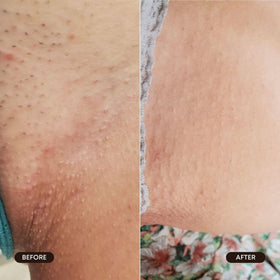 Bushbalm application underarm demonstrating gentle, even coverage