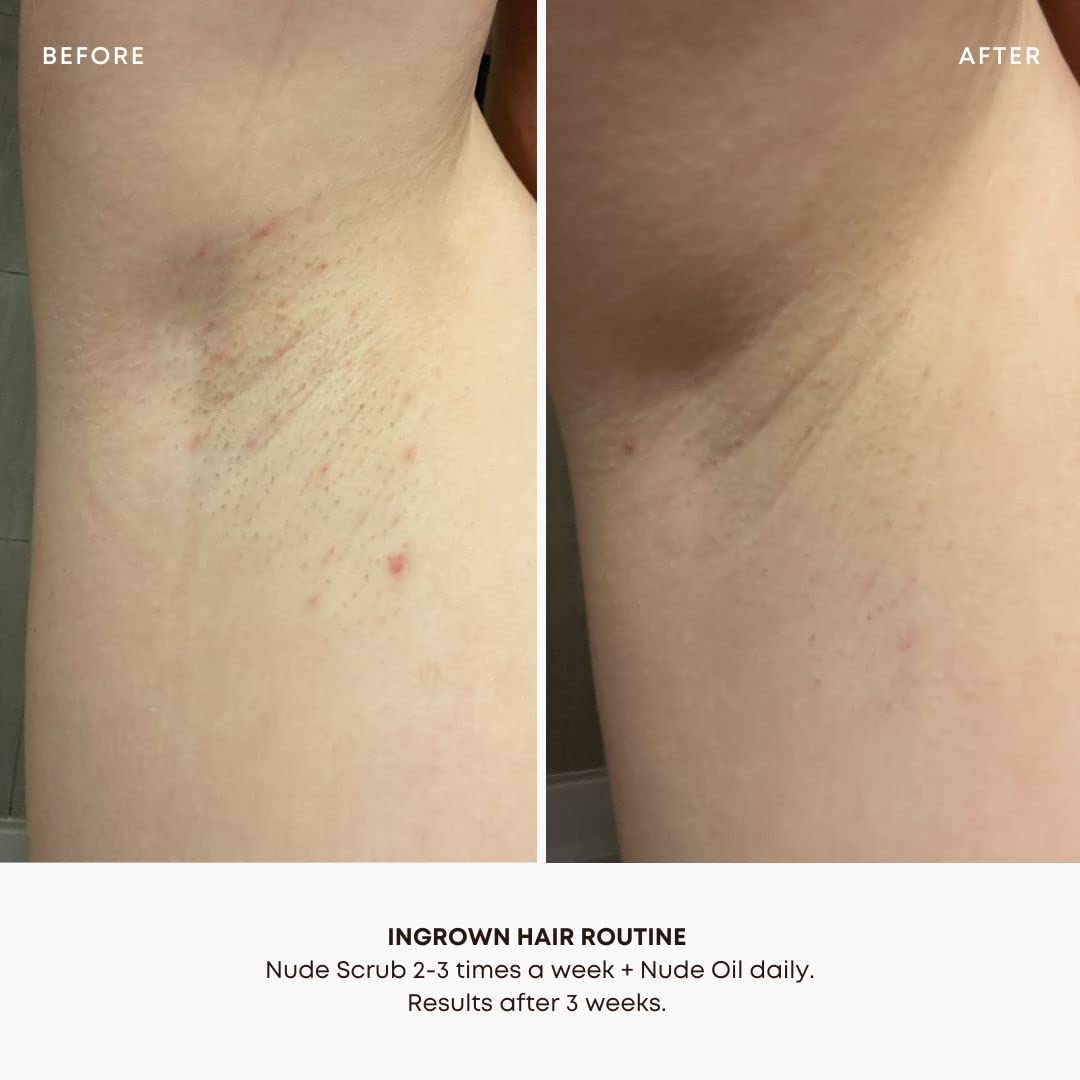 Bushbalm oil dropper applying a droplet to skin, demonstrating quick absorption benefit