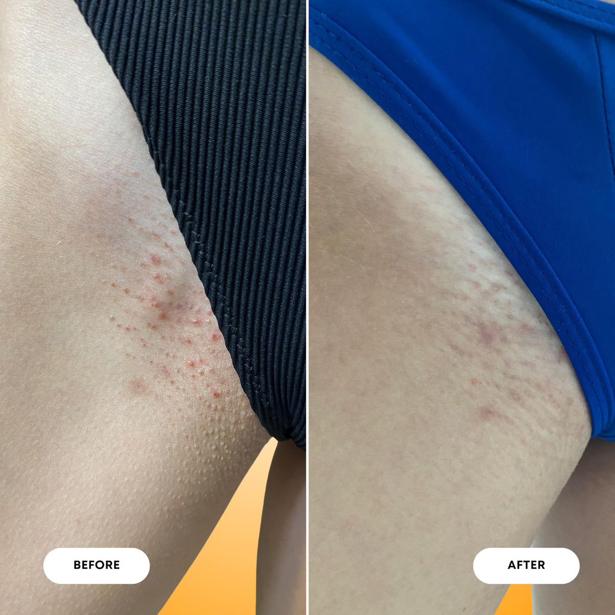 Bushbalm oil massaged into skin post-shower calming razor bumps effectively