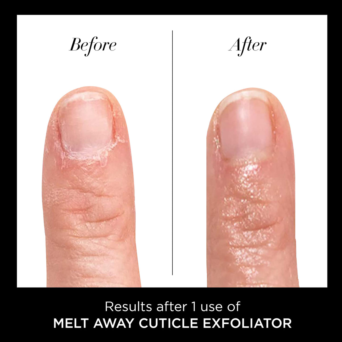 butter LONDON before and after cuticle edge for neater nails