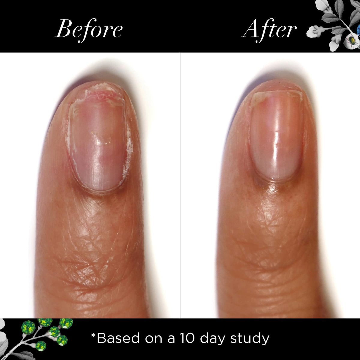 butter LONDON before and after nailbed comparison shows improved strength
