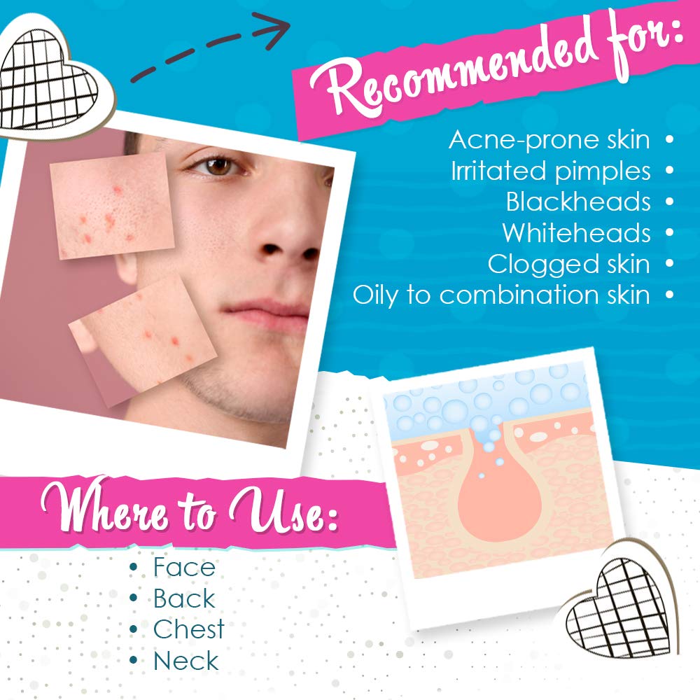 Bye Bye Blemish application on skin showing precise spot treatment benefit