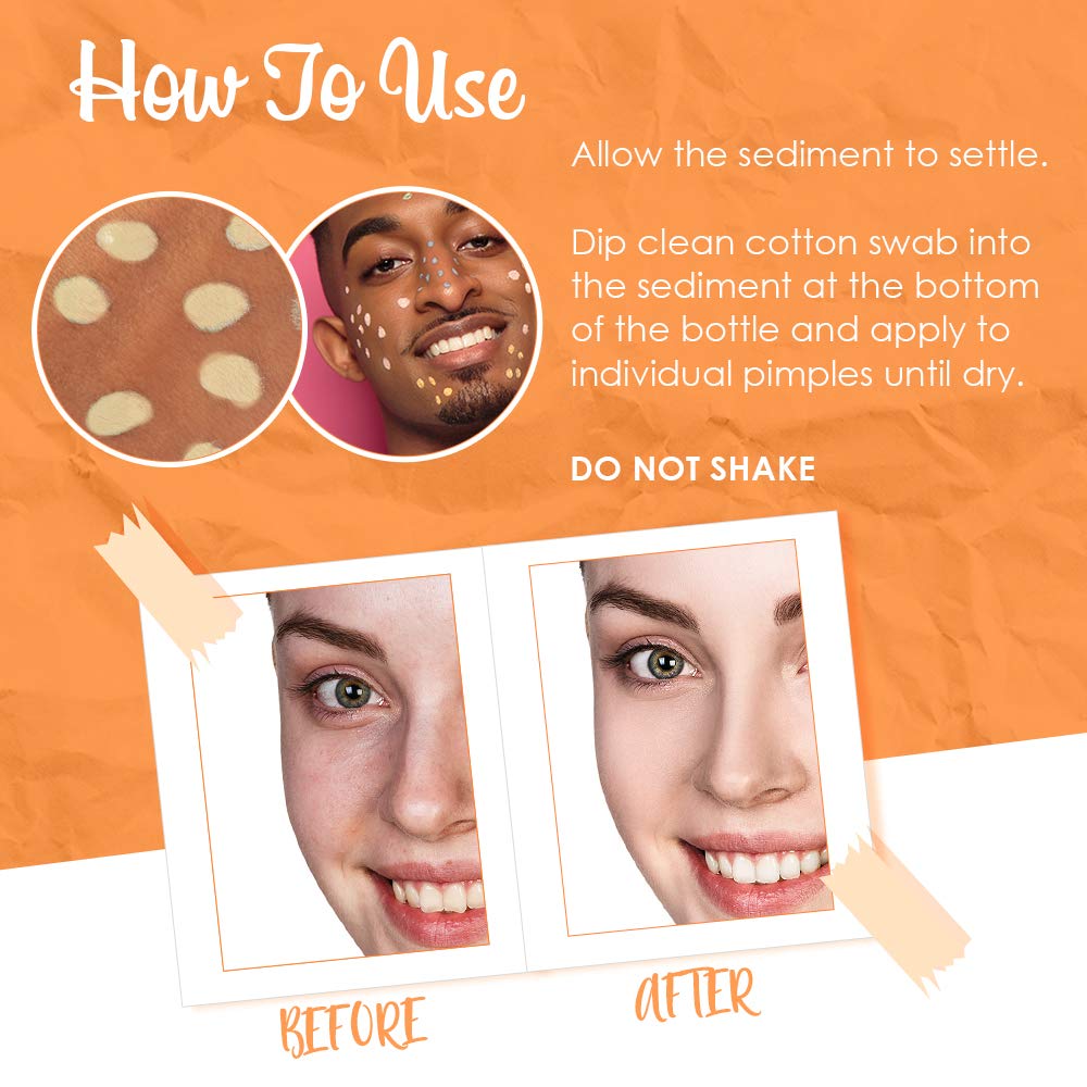 Bye Bye Blemish bottle beside ruler illustrating compact one ounce benefit