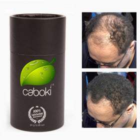 lifestyle image of man and woman using Caboki showing everyday confidence and natural results