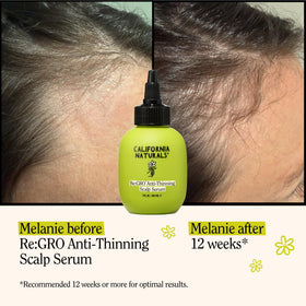 California Naturals pipette dispensing serum for precise scalp targeting