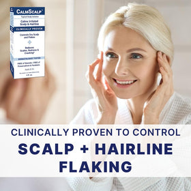 CalmScalp bottle shown next to a hand for scale, helpful for sizing expectation