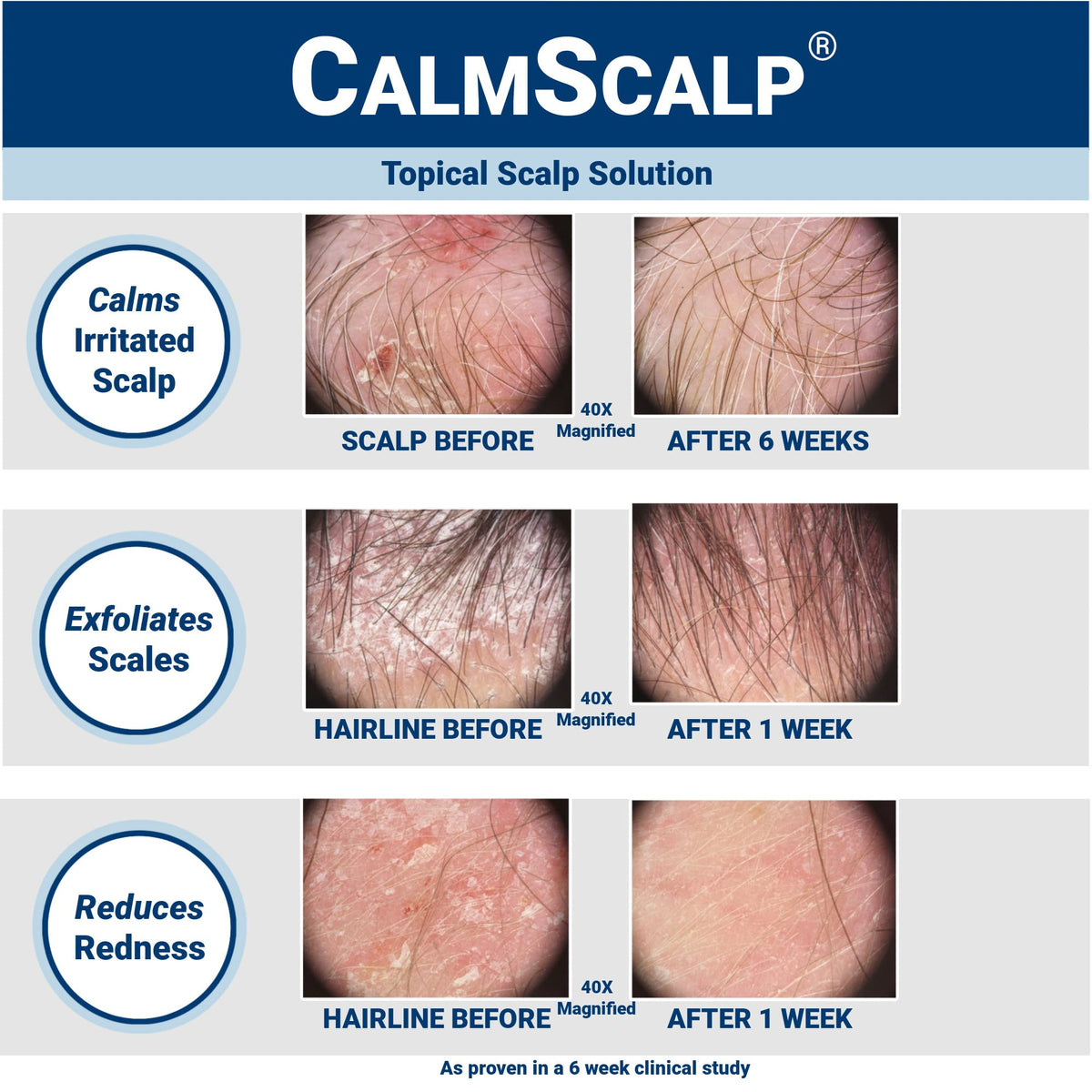 CalmScalp serum texture close-up highlighting lightweight consistency for quick absorption