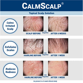 CalmScalp serum texture close-up highlighting lightweight consistency for quick absorption