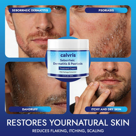 Calvris used on beard area to soothe dryness and itching