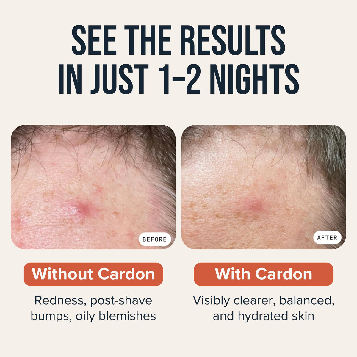 Cardon ingredient callout with salicylic acid niacinamide hyaluronic acid