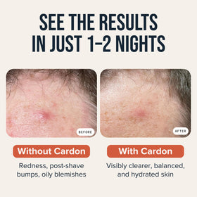 Cardon ingredient callout with salicylic acid niacinamide hyaluronic acid