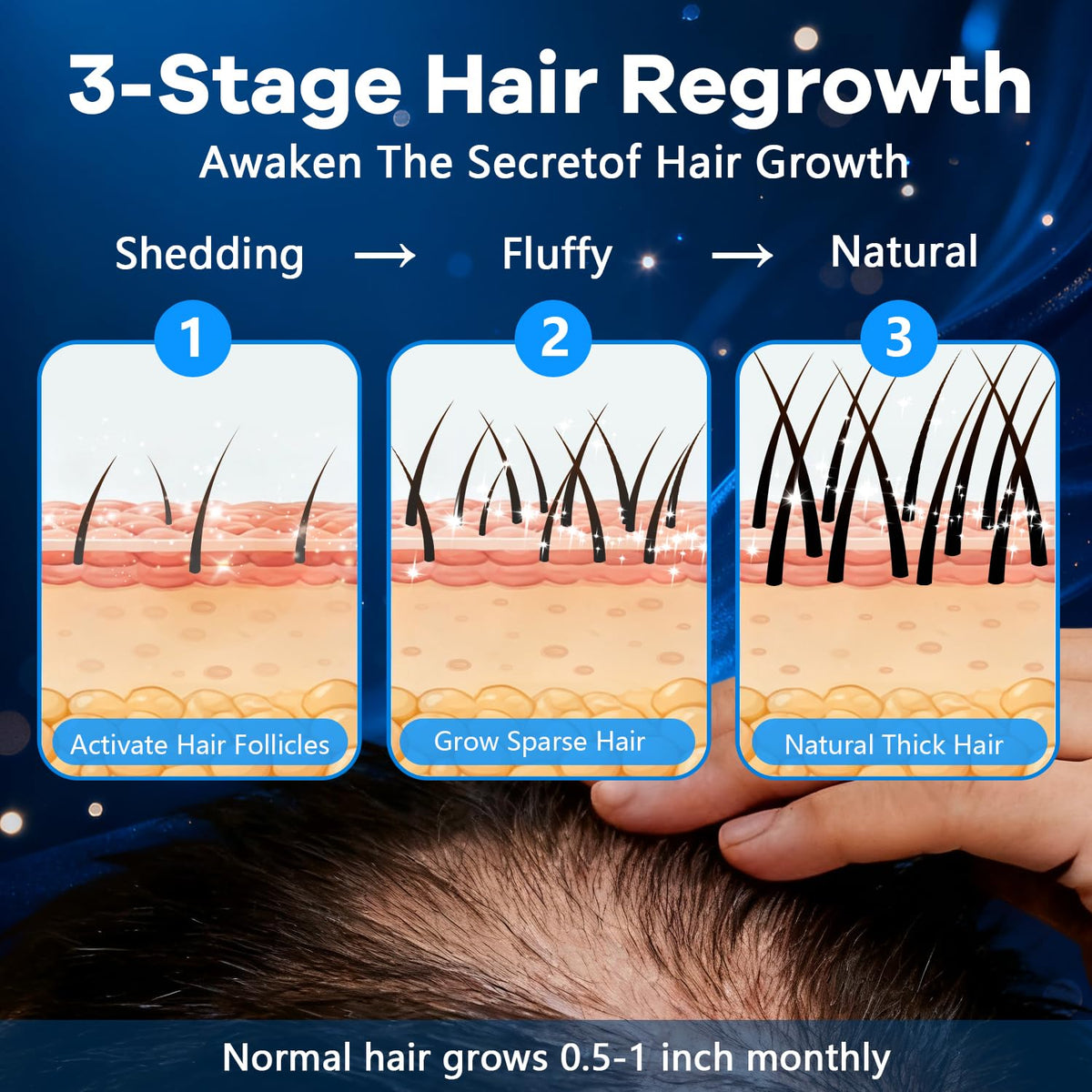 CARENICE used on beard area illustrating fuller-looking facial hair support