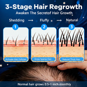 CARENICE used on beard area illustrating fuller-looking facial hair support