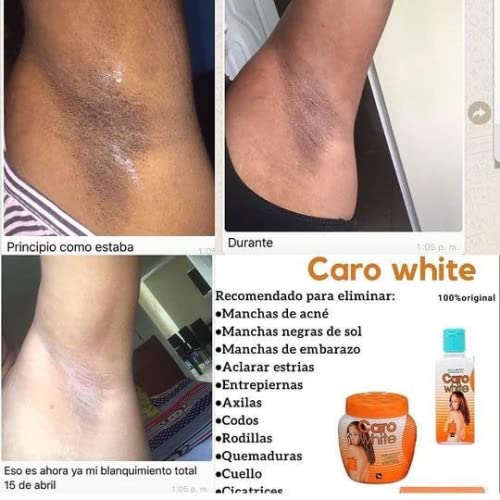 Caro White close-up of lotion and cream texture illustrating fast absorption and smooth finish