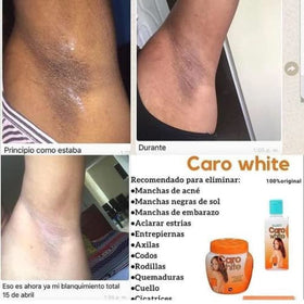 Caro White close-up of lotion and cream texture illustrating fast absorption and smooth finish