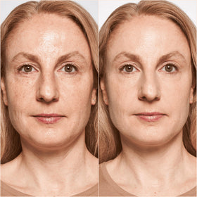 Catrice foundation applied on model showing natural, airbrushed effect