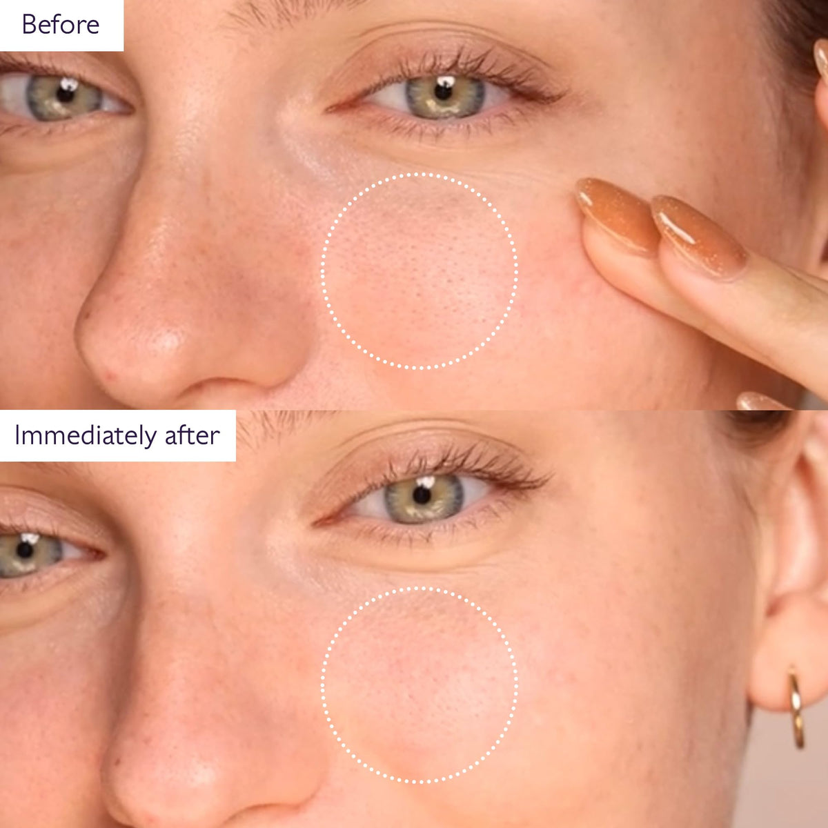 Model with Caudalie mask on cheek showing even coverage and quick treatment
