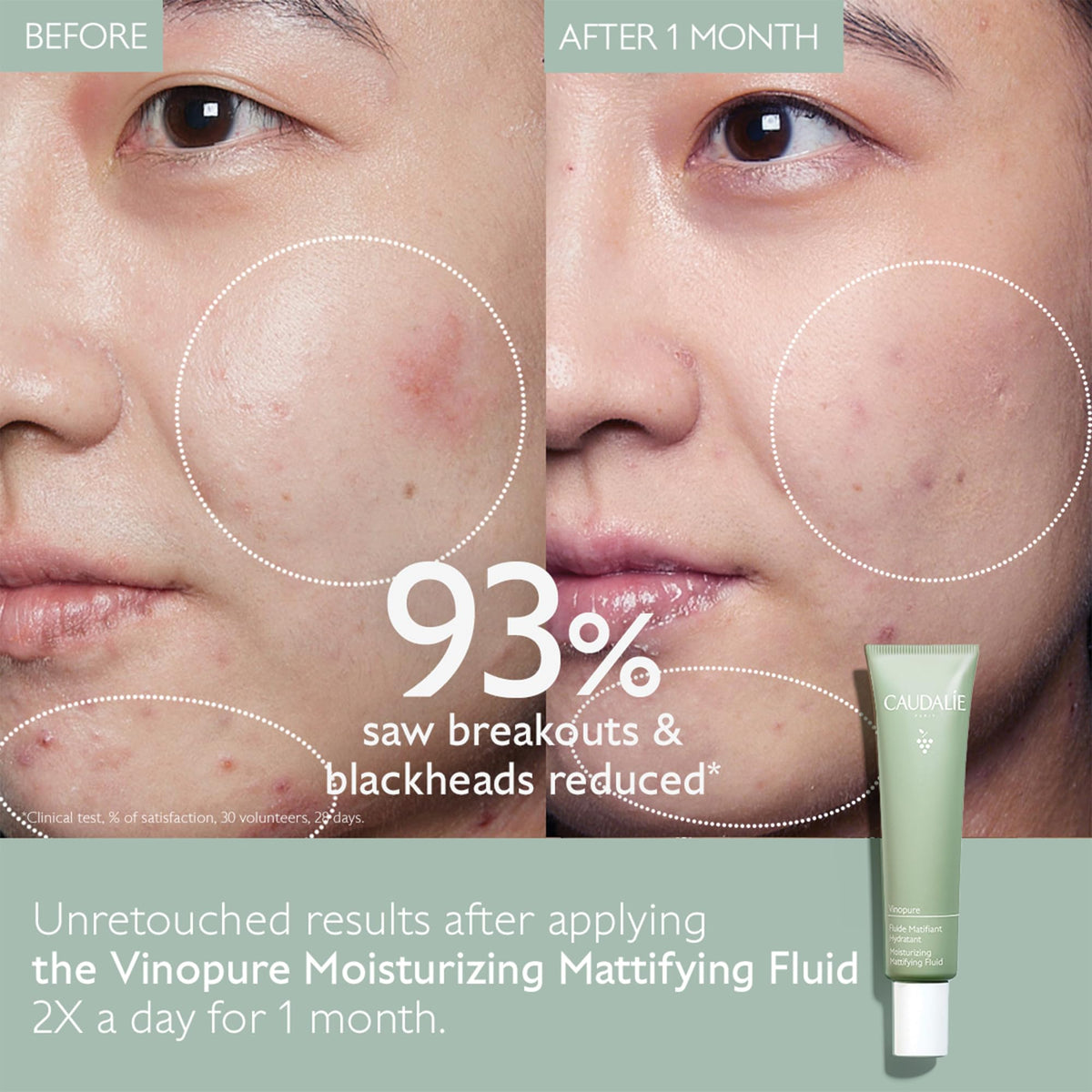 Caudalie open jar contents revealing smooth gel-cream and mattifying finish
