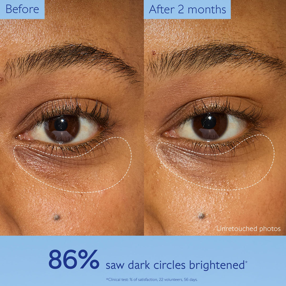 Caudalie Vinoperfect highlighting caffeine ingredient to reduce puffiness