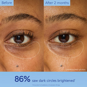 Caudalie Vinoperfect highlighting caffeine ingredient to reduce puffiness