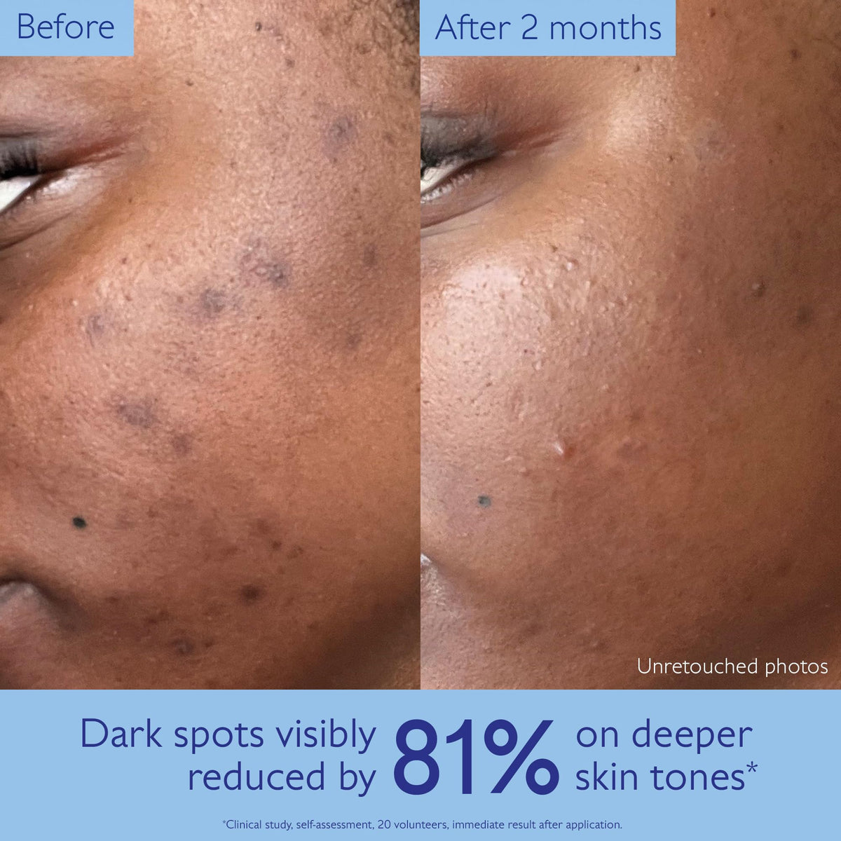 Caudalie serum drop on hand showing absorbent, non-greasy hydration