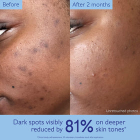Caudalie serum drop on hand showing absorbent, non-greasy hydration