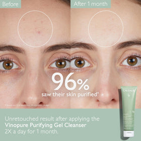 Caudalie gel texture close-up shows lightweight consistency for gentle cleansing
