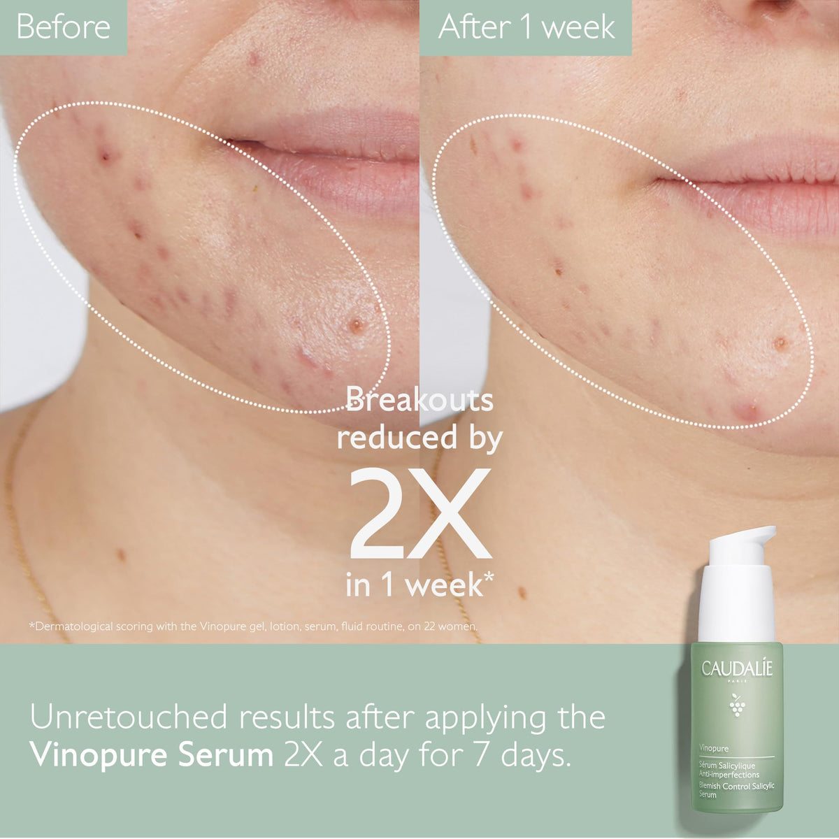 Caudalie serum texture on hand showing lightweight gel for quick absorption