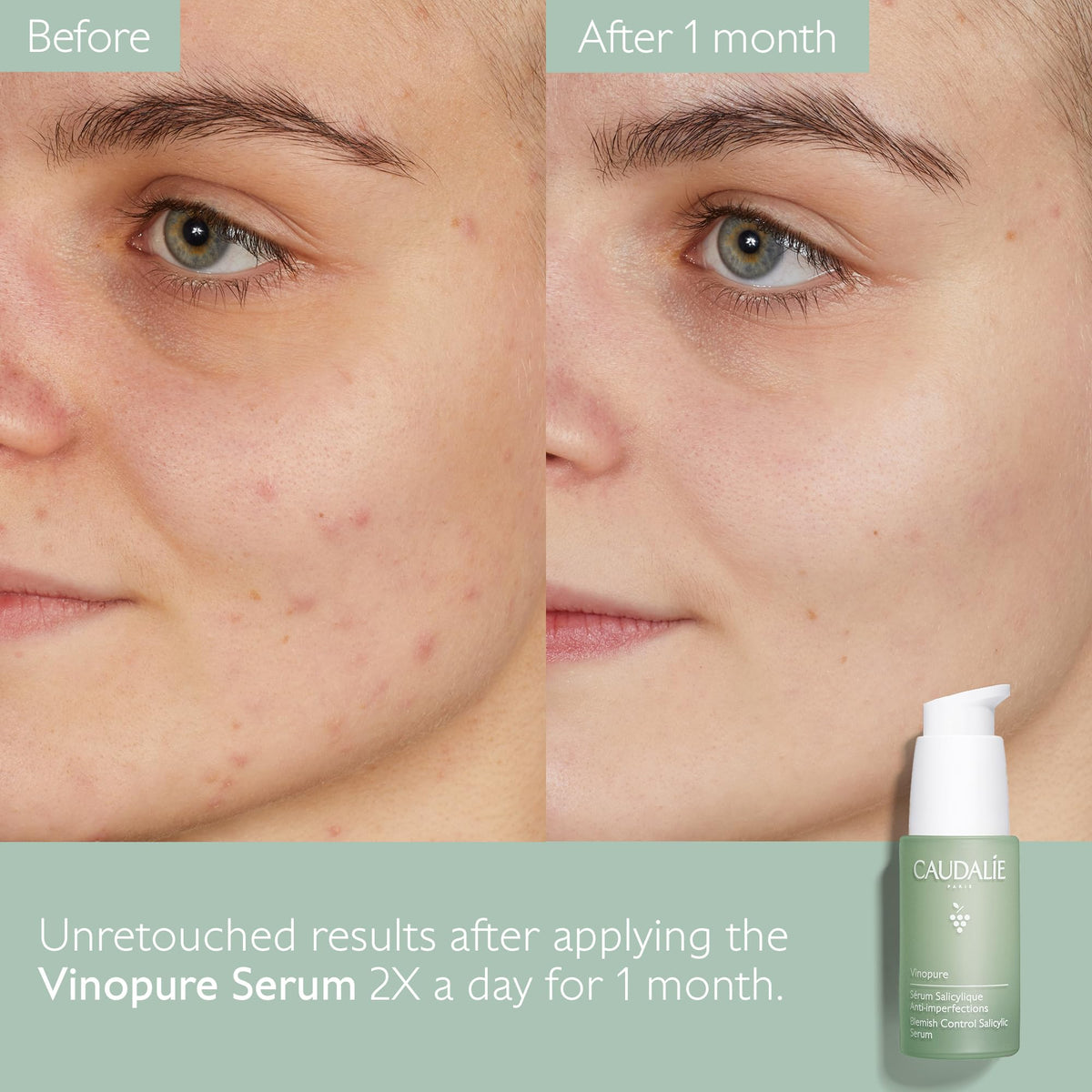 Applying Caudalie serum to face demonstrating targeted pore care