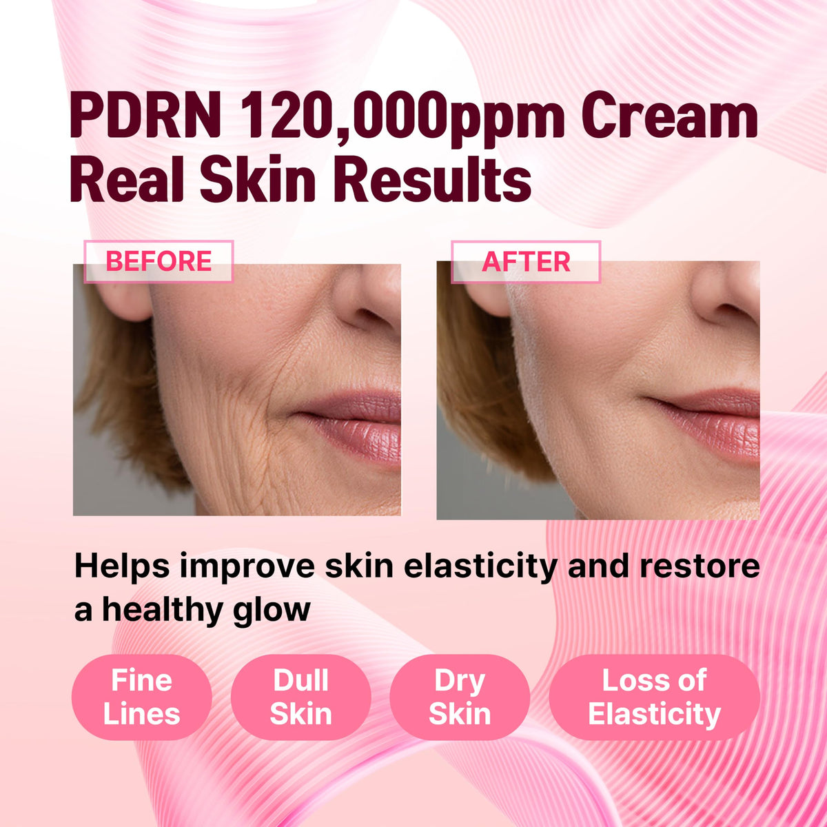 CELDYQUE cream being applied on hand demonstrating calming hydration benefit