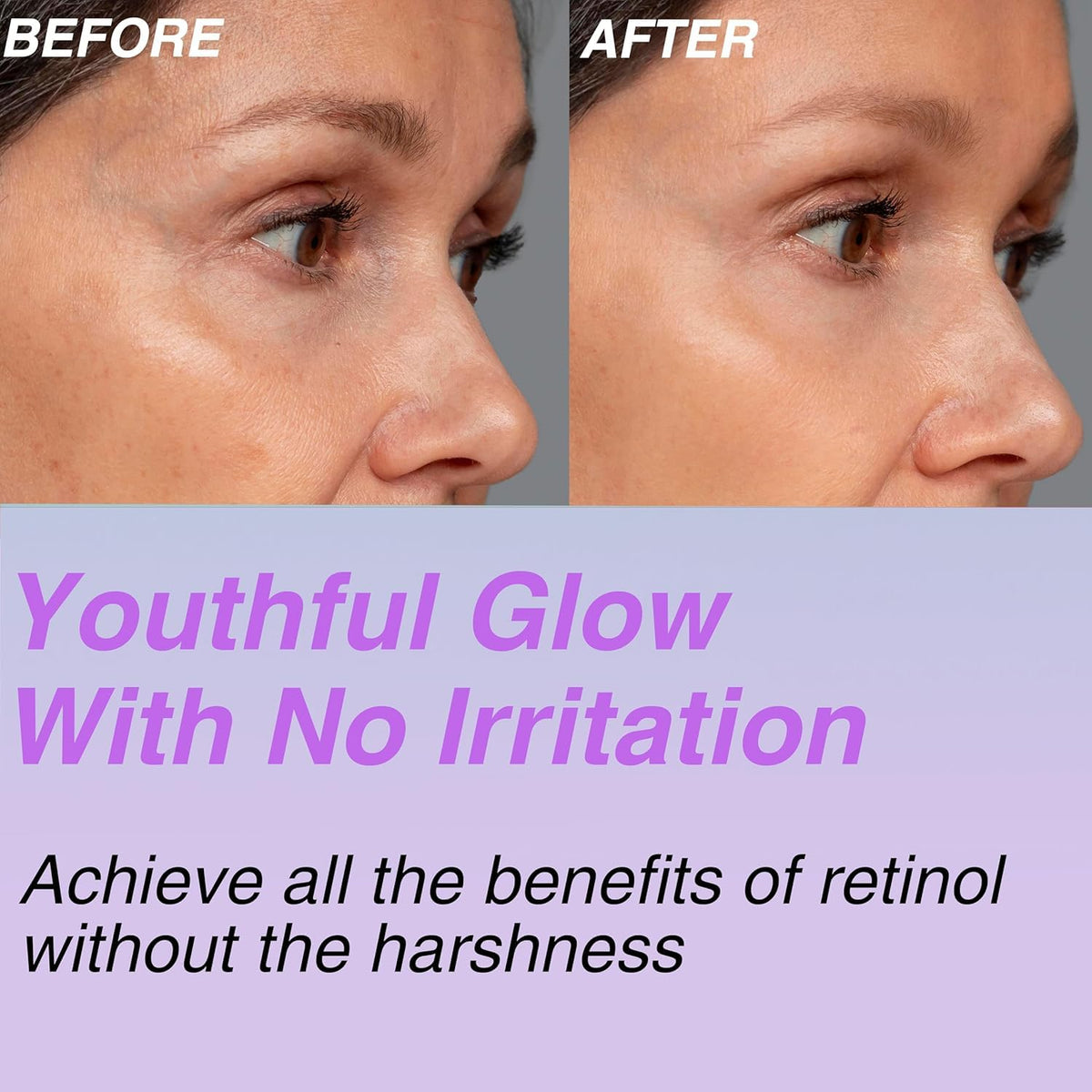 CELDYQUE Bakuchiol ingredient extract visual suggesting gentle retinol-alternative benefits