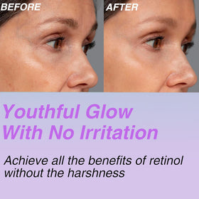 CELDYQUE Bakuchiol ingredient extract visual suggesting gentle retinol-alternative benefits