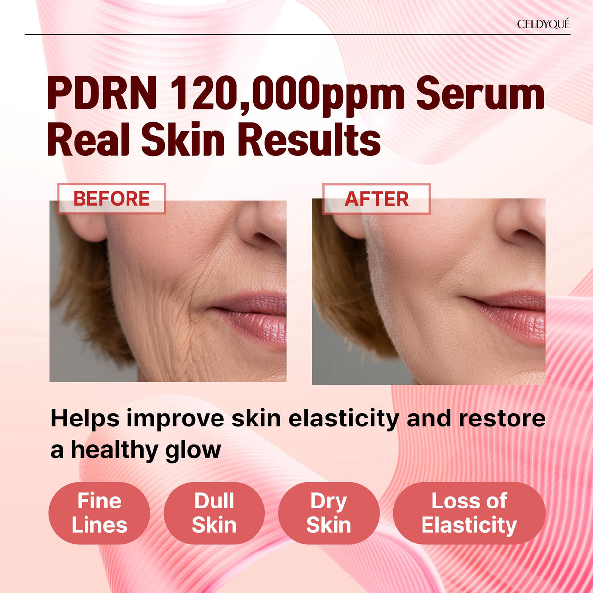 CELDYQUE close-up of serum surface highlighting PDRN-rich texture for repair