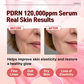 CELDYQUE close-up of serum surface highlighting PDRN-rich texture for repair