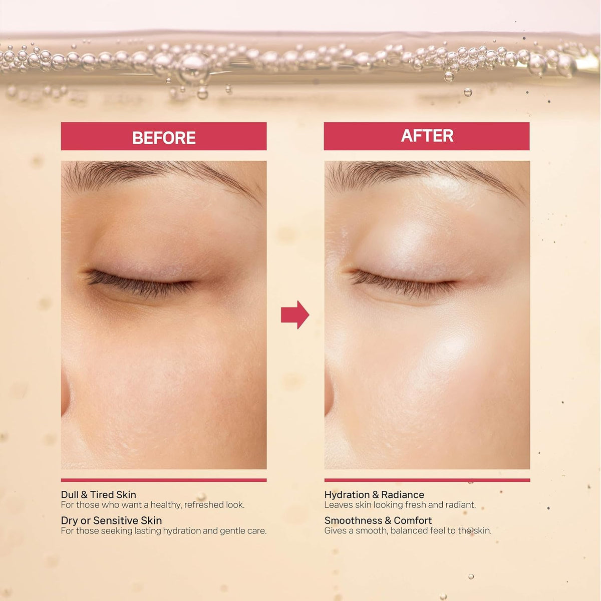 CELDYQUE microneedling setup illustrating post-treatment booster use
